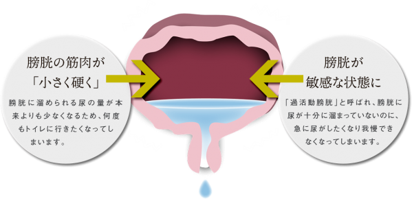 まずは夜間尿の原因を探ってみた。